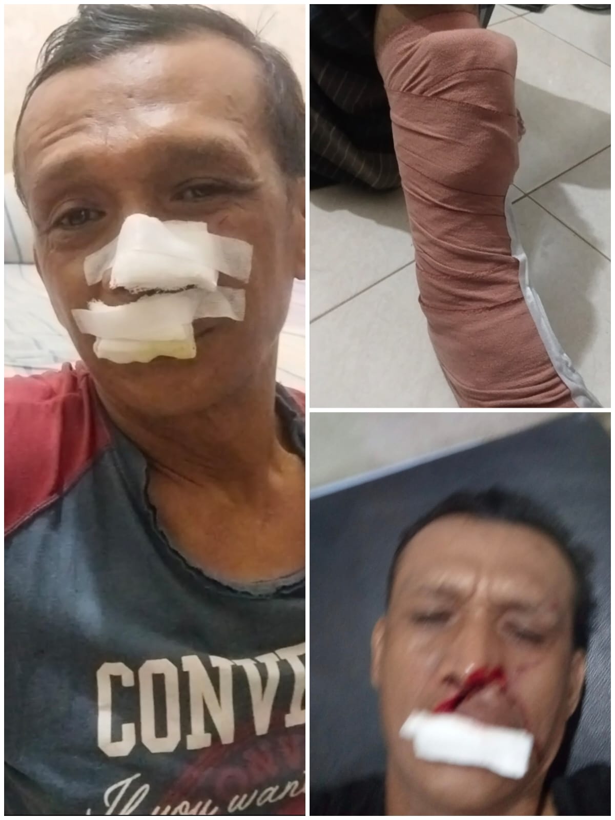 Sadis!!.. Dibacok 3 Pemuda hingga Tendon Kaki Putus, Keluarga Arfan Desak Polisi Segera Tangkap Pelaku